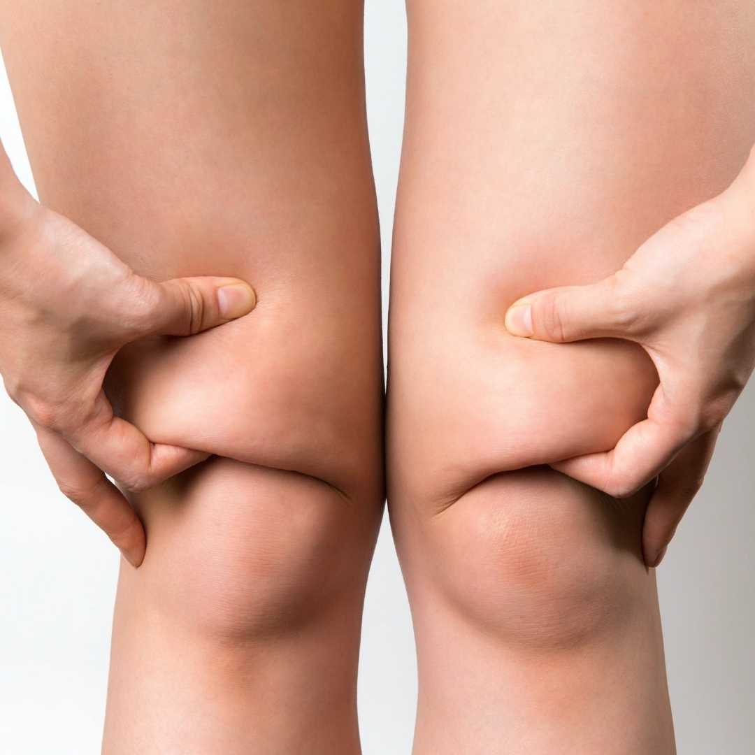 knee fat