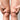 knee fat