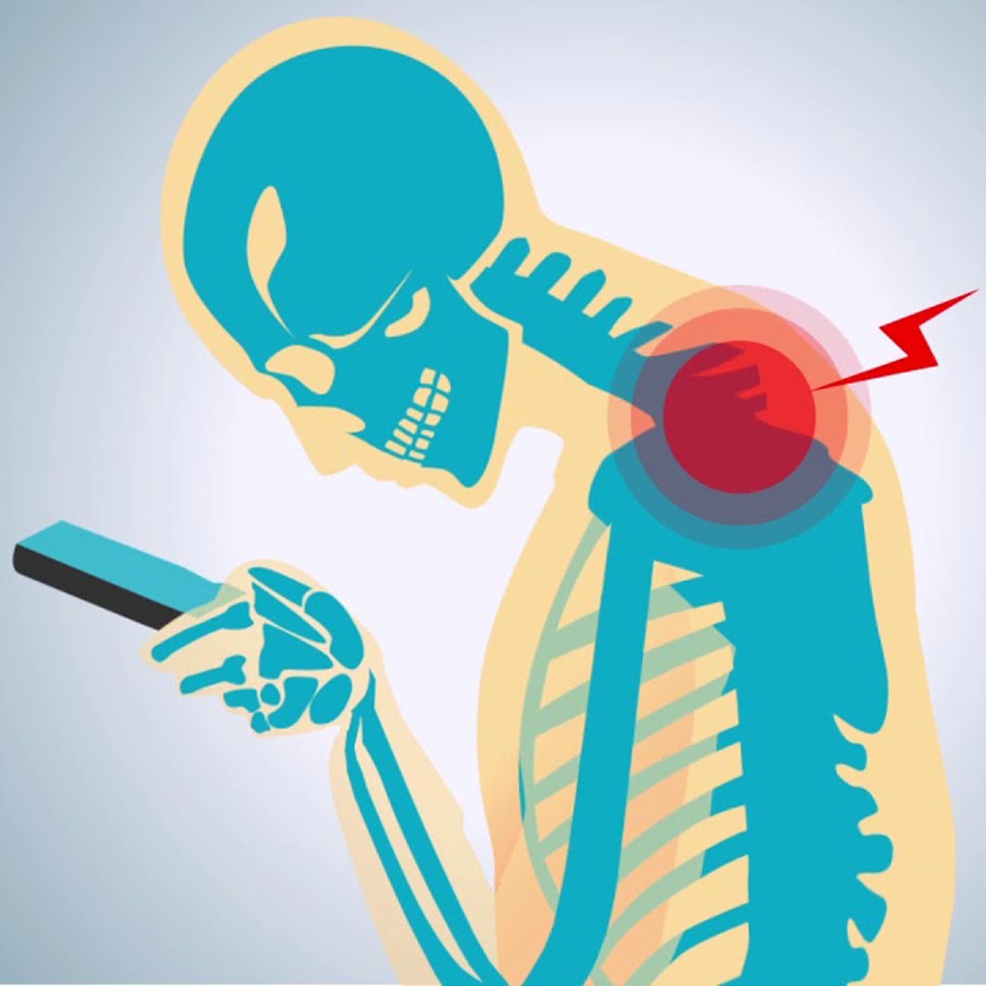 tech neck exercises