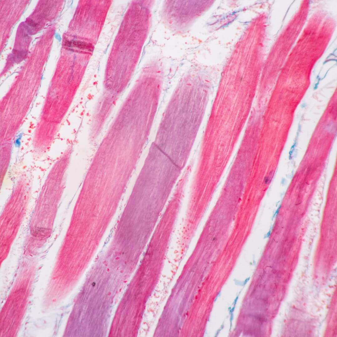 types of muscle fibers