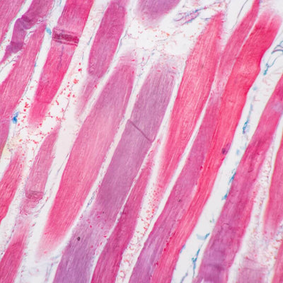 types of muscle fibers